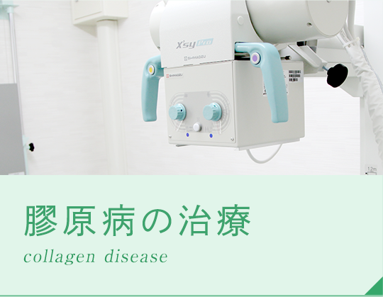 膠原病の治療
